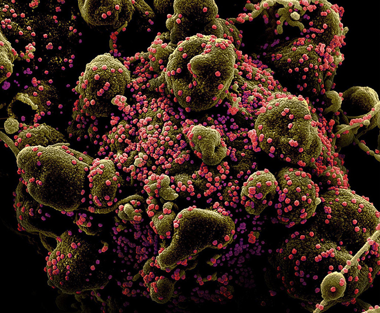 İşte Coronavirüs’ün mikroskopla görünüşü