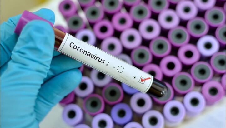 Coronavirüs’te can kaybı 6 bin 209 oldu