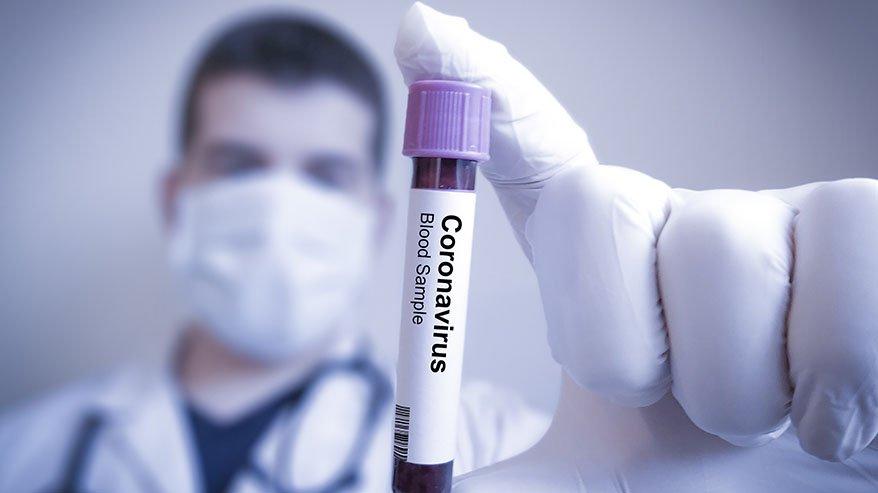 Coronavirüs’e 15 kurban daha