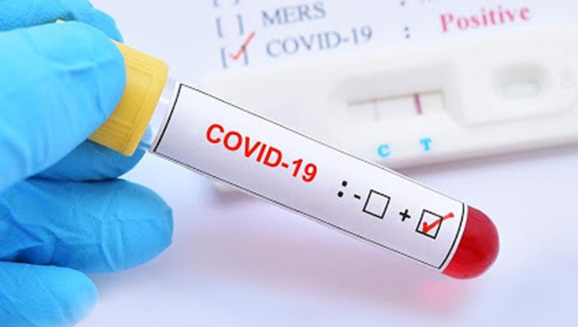 Coronavirüs’te korkutan bilanço