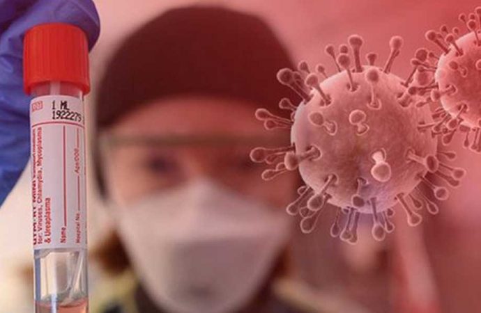 Coronavirüs’te can kaybı 5 bin 728 oldu