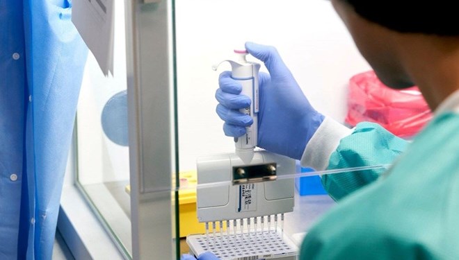 PCR testi poztifi çıkan hastanın masrafı devletten