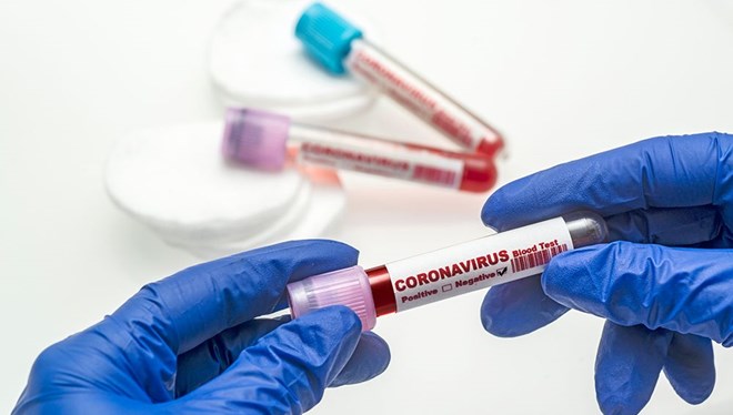 Coronavirüs’te iyimser tablo