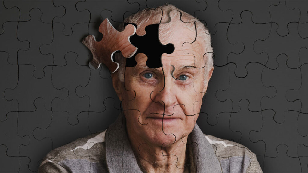 Alzheimer’ın 10 önemli sinyali açıklandı
