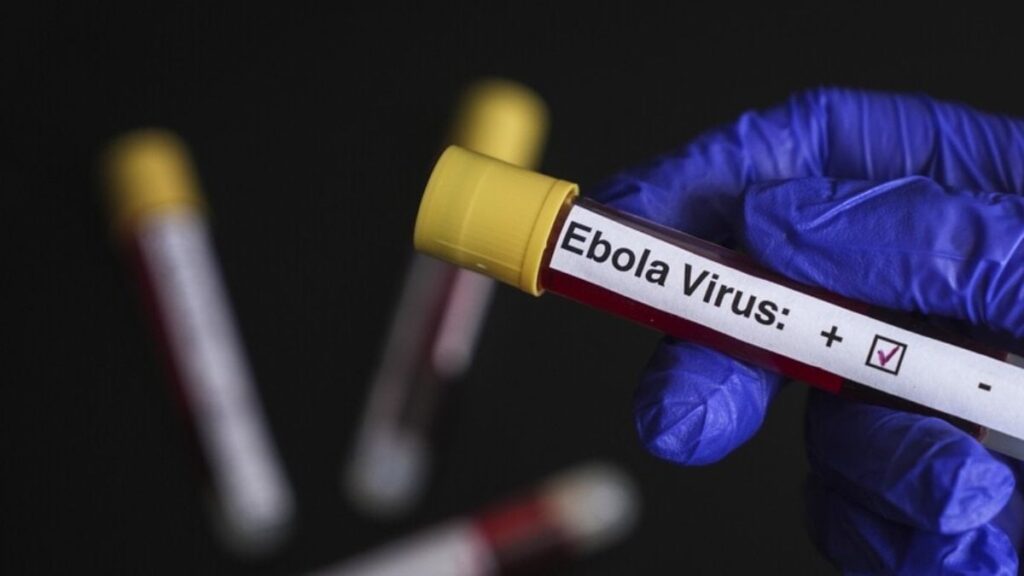 Fransa’da doğrulanan ilk Ebola vakası